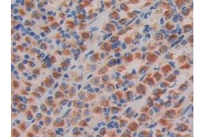 Immunohistochemistry (IHC) image for anti-Natural Killer Cell Receptor 2B4 (CD244) (AA 20-221) antibody (ABIN7441829)