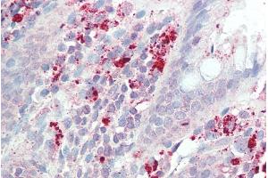 ABIN2613443 (5µg/ml) staining of paraffin embedded Human Colon. (IL3RA Antikörper  (Internal Region))
