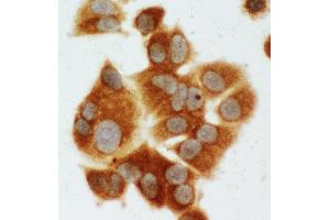 Anti-MEK1 antibody, ICC ICC: MCF-7 Cell (MEK1 Antikörper  (C-Term))