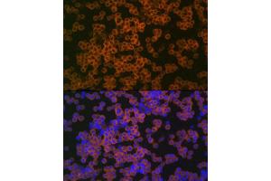 Immunofluorescence analysis of THP-1 cells using CD38 Rabbit pAb (ABIN6130076, ABIN6138177, ABIN6138178 and ABIN6217677) at dilution of 1:100 (40x lens). (CD38 Antikörper  (AA 46-300))