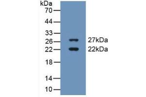 Western blot analysis of recombinant Human CIRBP. (CIRBP Antikörper  (AA 1-172))