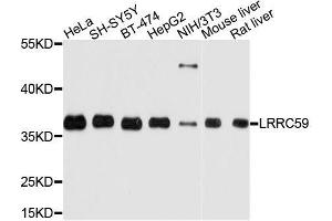 Western blot analysis of extracts of various cell lines, using LRRC59 antibody. (LRRC59 Antikörper  (AA 1-244))