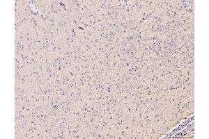 IHC analysis of MT-CO2 using anti-MT-CO2 antibody (ABIN7599081). (COX2 Antikörper  (AA 1-205))