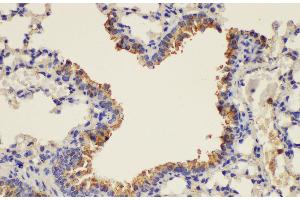 Immunohistochemistry of paraffin-embedded Mouse lung using PLAUR Ployclonal Antibody at dilution of 1:200. (PLAUR Antikörper)
