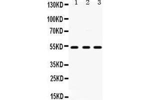 Western Blotting (WB) image for anti-5-Hydroxytryptamine (serotonin) Receptor 2A (HTR2A) (AA 400-431), (C-Term) antibody (ABIN3042729) (HTR2A Antikörper  (C-Term))