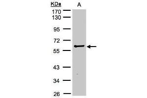 WB Image Sample(30 μg of whole cell lysate) A:Raji, 10% SDS PAGE antibody diluted at 1:2000 (RIPK2 Antikörper)