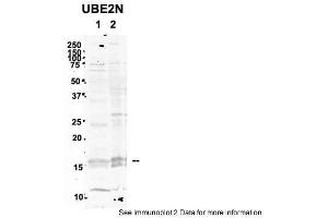 Sample Type: 1. (UBE2N Antikörper  (Middle Region))
