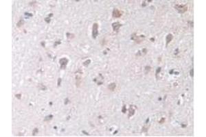 IHC-P analysis of Human Brain Tissue, with DAB staining. (STIP1 Antikörper  (AA 1-169))