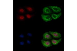 ABIN6256199 and ABIN6267172 staining Heat-shock treated Hela cells by IF/ICC. (RPS6KA3 Antikörper  (pSer227))