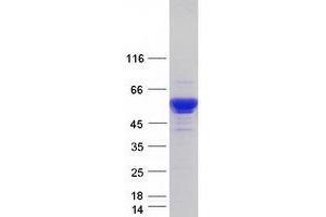 Validation with Western Blot (SERPINA1 Protein (Transcript Variant 6) (Myc-DYKDDDDK Tag))