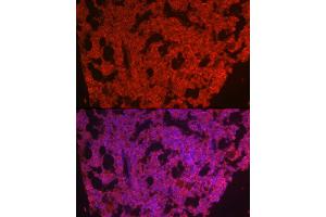 Immunofluorescence analysis of mouse bone marrow cells using CSF1R Rabbit pAb (ABIN3017197, ABIN3017198, ABIN3017199 and ABIN6219993) at dilution of 1:100 (40x lens). (CSF1R Antikörper)