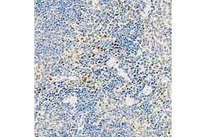 Immunohistochemistry analysis of paraffin-embedded mouse speen using,NLRP1 (ABIN7074850) at dilution of 1: 1000