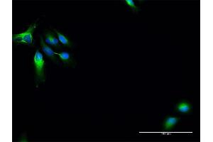 Immunofluorescence of purified MaxPab antibody to MAP7 on HeLa cell.