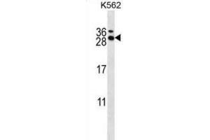 Western Blotting (WB) image for anti-RCAN Family Member 3 (RCAN3) antibody (ABIN2997962) (RCAN3 Antikörper)
