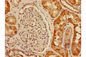 Immunohistochemistry of paraffin-embedded human kidney tissue using ABIN7175150 at dilution of 1:100 (USHBP1 Antikörper  (AA 1-260))