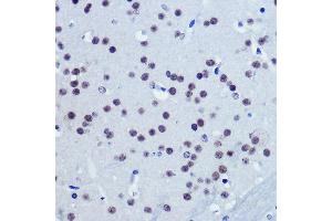 Immunohistochemistry of paraffin-embedded Mouse brain using Vgll4 Rabbit pAb (ABIN7271320) at dilution of 1:100 (40x lens). (VGLL4 Antikörper)