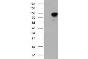 Western Blotting (WB) image for anti-phosphoinositide-3-Kinase Adaptor Protein 1 (PIK3AP1) antibody (ABIN1496821) (PIK3AP1 Antikörper)