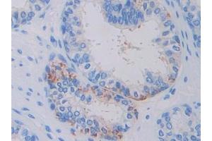Used in DAB staining on fromalin fixed paraffin- embedded glioma tissue (Factor VII Antikörper  (AA 334-452))