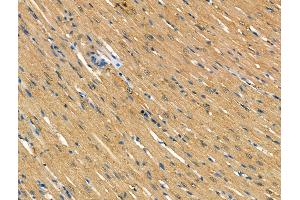 ABIN7094629 and ABIN7098679 at 1/100 staining Rat heart tissue by IHC-P. (TOM1L2 Antikörper  (Internal Region))