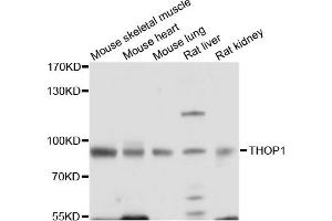 Western blot analysis of extracts of various cell lines, using THOP1 antibody. (Thimet Oligopeptidase 1 Antikörper)