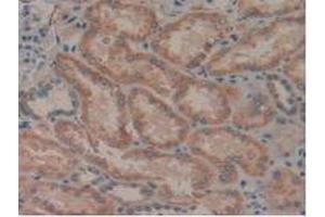 IHC-P analysis of Human Kidney Tissue, with DAB staining. (LGALS8 Antikörper  (AA 1-317))