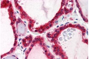 anti-Stromal Interaction Molecule 1 (STIM1) (C-Term) antibody