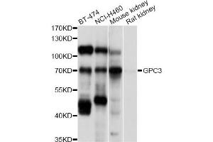 Western blot analysis of extracts of various cell lines, using GPC3 antibody (ABIN5997818) at 1/1000 dilution. (Glypican 3 Antikörper)