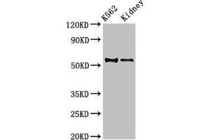Western Blot Positive WB detected in: K562 whole cell lysate, Mouse kidney tissue All lanes: ALDH1A2 antibody at 3.