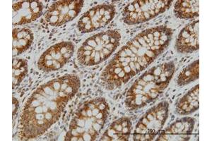 Image no. 1 for anti-NADH Dehydrogenase (Ubiquinone) Fe-S Protein 4, 18kDa (NADH-Coenzyme Q Reductase) (NDUFS4) (AA 66-176) antibody (ABIN598831) (NDUFS4 Antikörper  (AA 66-176))