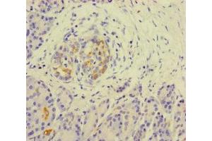Immunohistochemistry of paraffin-embedded human pancreatic tissue using ABIN7157290 at dilution of 1:100 (KLHL3 Antikörper  (AA 1-301))