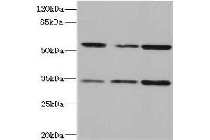 Western blot All lanes: IL17RB antibody at 2. (IL17 Receptor B Antikörper  (AA 18-292))