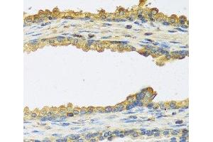 Immunohistochemistry of paraffin-embedded Human prostate using TSHB Polyclonal Antibody at dilution of 1:100 (40x lens). (TSHB Antikörper)