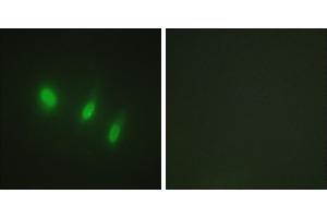 Peptide - +Western blot analysis of extracts from K562 cells, using FOXO4 (Ab-451) antibody. (FOXO4 Antikörper)