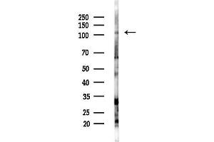 anti-Mitogen-Activated Protein Kinase Kinase Kinase 14 (MAP3K14) (C-Term) antibody