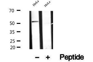 Western blot analysis of extracts of HeLa cells, using Secretogranin III antibody. (SCG3 Antikörper  (Internal Region))