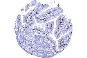 Duodenum mucosa Duodenal mucosa containing numerous intraepithelial CD8 positive lymphocytes (Rekombinanter CD8 Antikörper  (AA 135-235))