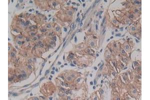 Immunohistochemistry (IHC) image for anti-ATP-Binding Cassette, Sub-Family C (CFTR/MRP), Member 4 (ABCC4) (AA 1041-1274) antibody (ABIN1866481)