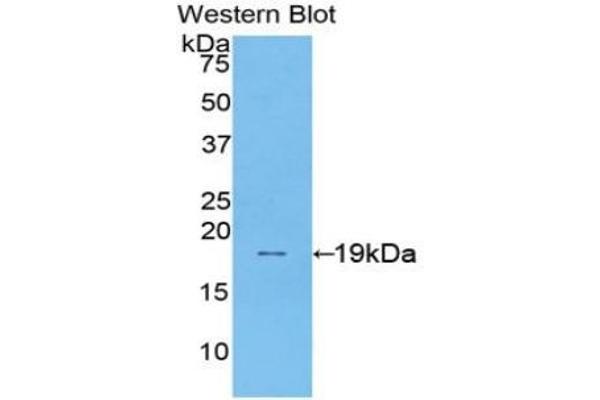 Sucrase Isomaltase Antikörper  (AA 1717-1827)