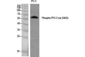 Western Blot (WB) analysis of specific cells using Phospho-PFK-2 car (S483) Polyclonal Antibody.