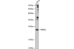 Western blot analysis of extracts of HeLa cells, using PTRH1 antibody (ABIN7269210) at 1:1000 dilution. (PTRH1 Antikörper  (AA 1-214))