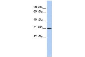 WB Suggested Anti-ZNF771 Antibody Titration:  0. (ZNF771 Antikörper  (N-Term))