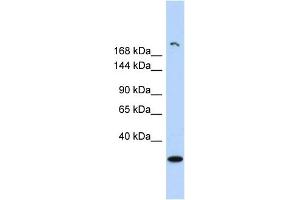 WB Suggested Anti-UTY Antibody Titration: 0. (UTY Antikörper  (Middle Region))