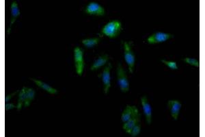 Immunofluorescence staining of Hela Cells with ABIN7127330 at 1:50, counter-stained with DAPI. (Rekombinanter AKR1C3 Antikörper)