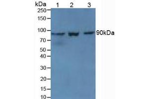Western blot analysis of (1) Mouse Kidney Tissue, (2) Mouse Spleen Tissue and (3) Mouse Placenta Tissue. (TGM1 Antikörper  (AA 337-607))
