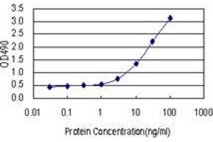 Sandwich ELISA detection sensitivity ranging from 1 ng/mL to 100 ng/mL. (SMYD2 (Human) Matched Antibody Pair)