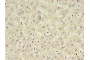 Immunohistochemistry of paraffin-embedded human liver tissue using ABIN7148394 at dilution of 1:100 (CFHR2 Antikörper  (AA 20-269))