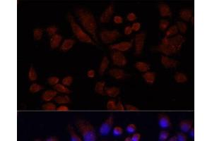 Immunofluorescence analysis of 293T cells using NAT2 Polyclonal Antibody at dilution of 1:100 (40x lens). (NAT2 Antikörper)