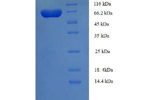 SDS-PAGE (SDS) image for UDP-Glucose Pyrophosphorylase 2 (UGP2) (AA 1-497), (Isoform 2) protein (His-SUMO Tag) (ABIN5711297) (UGP2 Protein (AA 1-497, Isoform 2) (His-SUMO Tag))