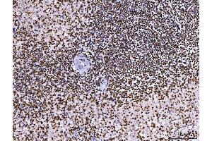IHC analysis of RCC1 using anti-RCC1 antibody (ABIN7600022).