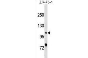 Western Blotting (WB) image for anti-Xeroderma Pigmentosum, Complementation Group C (XPC) antibody (ABIN3001097) (XPC Antikörper)